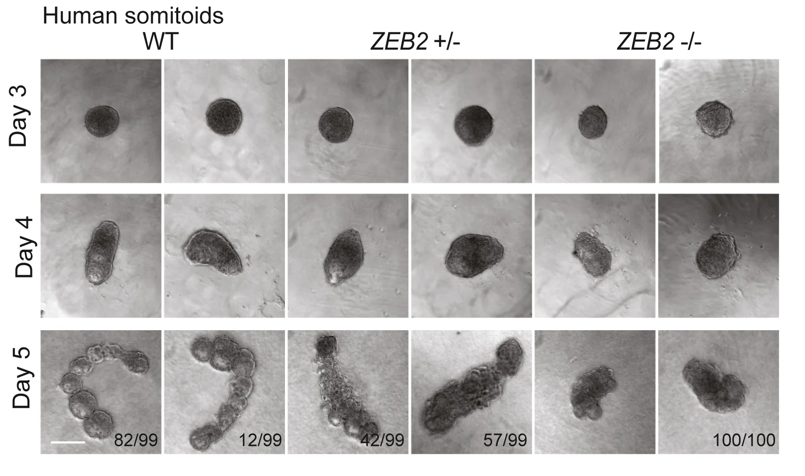 Open access visualization of Microscopy, Phase Contrast Images, Human Somitoid Development, Human iPSCs, ZEB2KO iPSCs