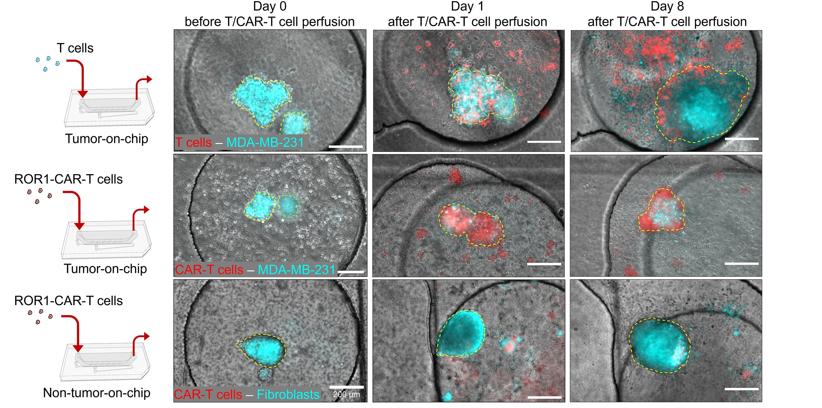 Open access visualization of Microscopy, Workflow, MDA-MB-231 Aggregates, Fibroblast Spheroids, CAR-T Cells