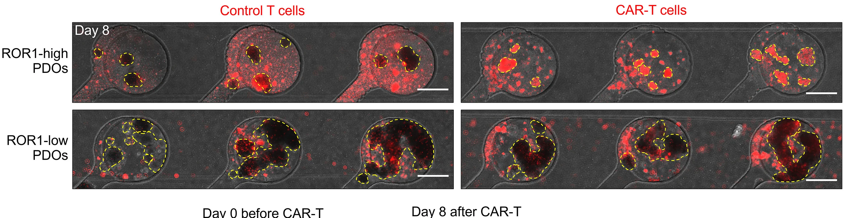 Open access visualization of Microscopy, ROR1, Tumor Organoids, T Cells, CAR-T Cells