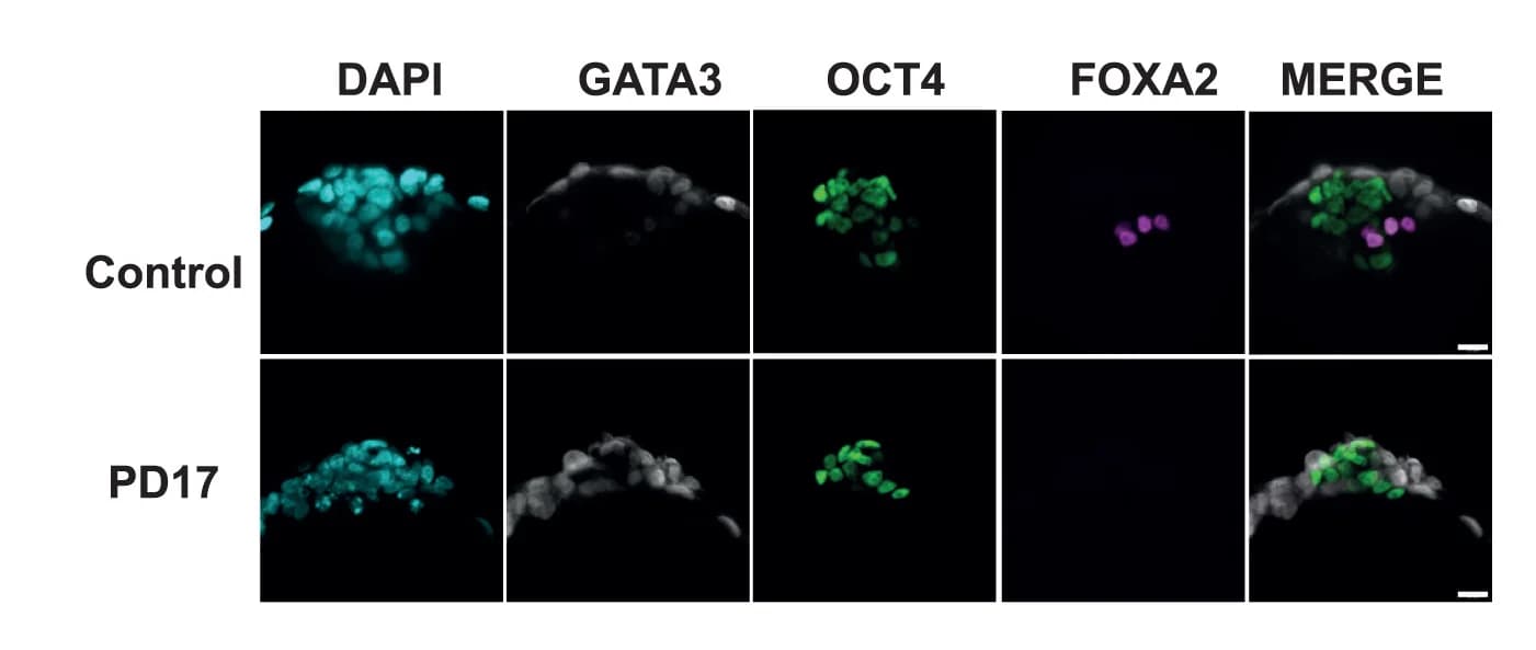 Open access visualization of Microscopy, Hypoblast Cells, HNES1 GATA3:mKO2 Blastoids, PD17 Treatment, Immunostaining