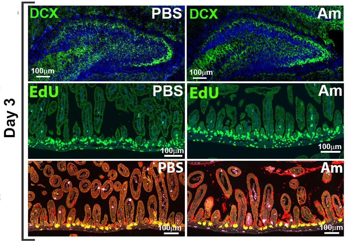 Open access visualization of Microscopy, Hippocampal Neurogenesis, Intestinal Proliferation, Multiplex Imaging, Intestinal Swiss Rolls