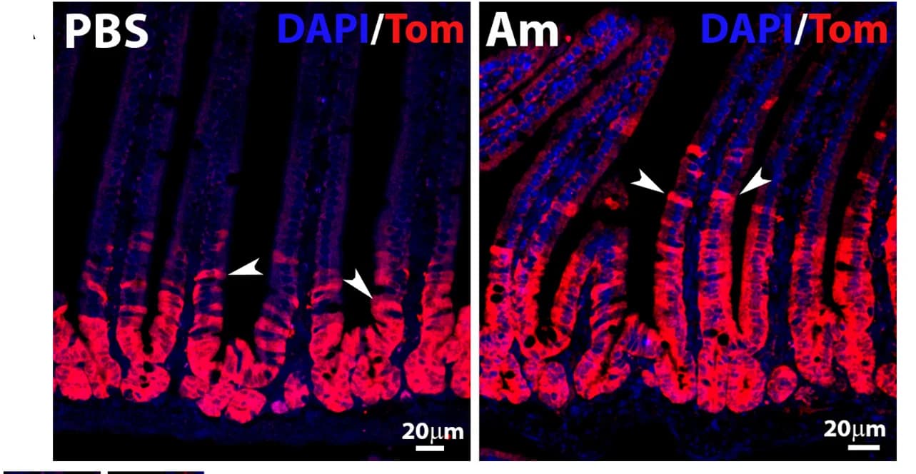 Open access visualization of Microscopy, Tomato, Intestines, Offspring, Tamoxifen