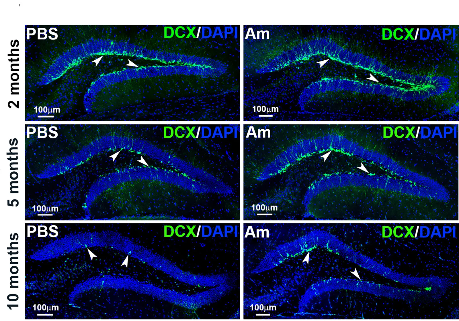 Open access visualization of Microscopy, DCX-stained Cells, Dentate Gyri, Offspring, DAPI Staining