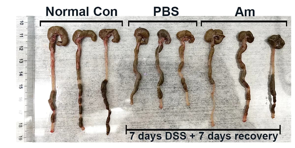 Open access visualization of Photo, Macroscopic Images, Colons, Cecums, Mice