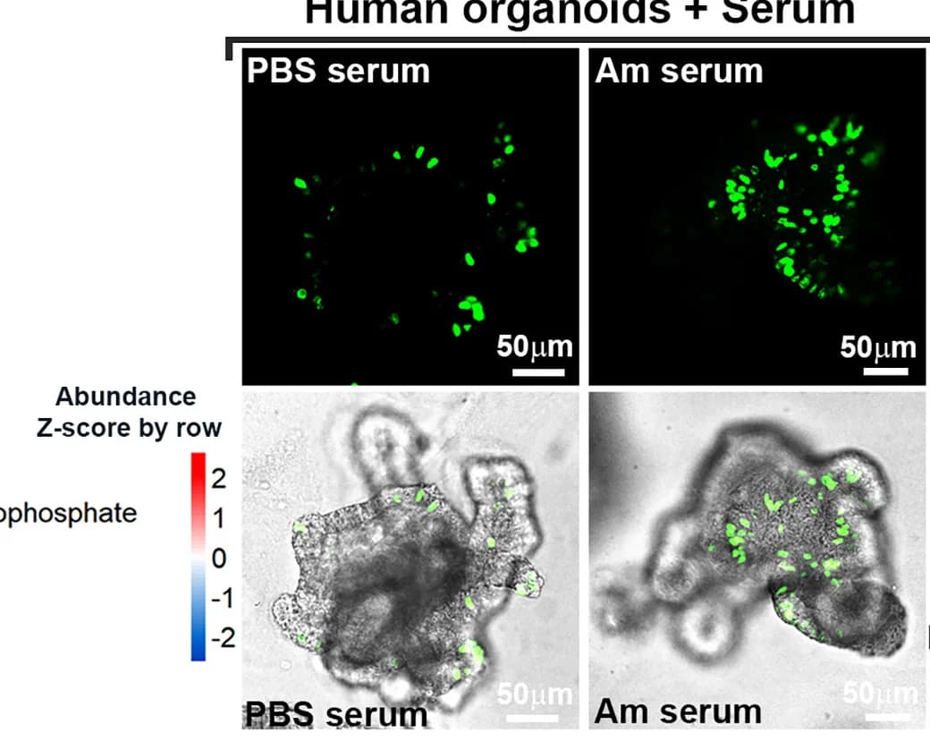 Open access visualization of Microscopy, EdU Staining, Human Organoids, Serum