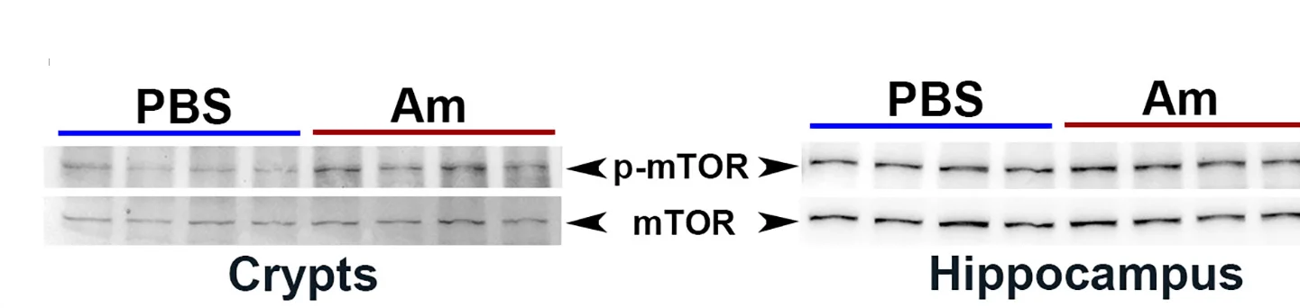 Open access visualization of Gel, Western Blot Analysis, mTOR Activation, Intestinal Crypts, Hippocampi