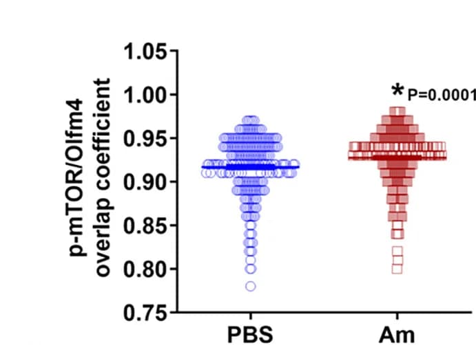Open access visualization of Scatter Plot, Quantification, mTOR Activity, Neuronal Stem Cells, Nestin+ Cells