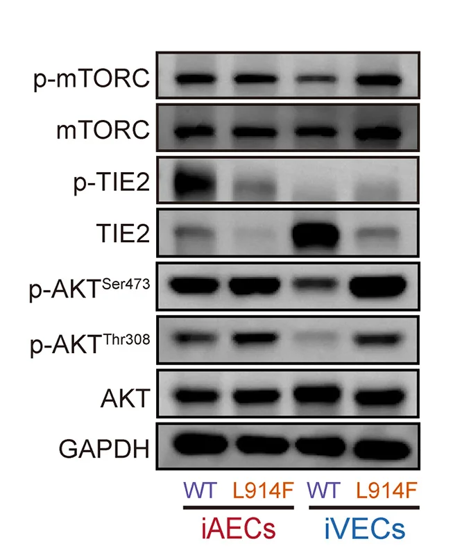 Open access visualization of Gel, Western Blots, p-mTORC, p-TIE2, p-AKTser473