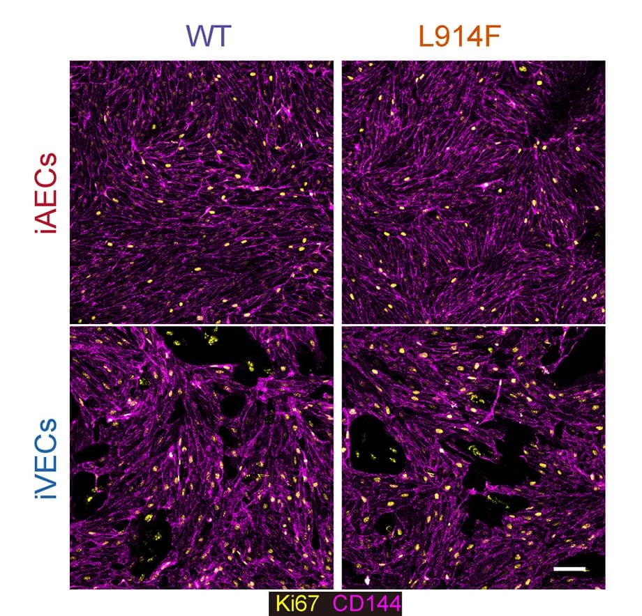 Open access visualization of Microscopy, Immunofluorescent Images, WT, L914F, iAECs