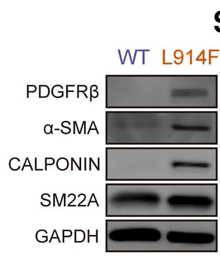 Open access visualization of Gel, Western Blots, PDGFRβ, α-SMA, Calponin