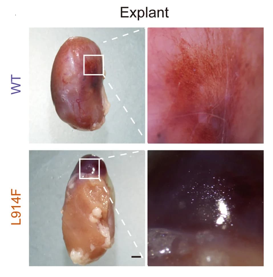 Open access visualization of Photo, Microscopy, Mouse Kidney, iVECs, Transplantation