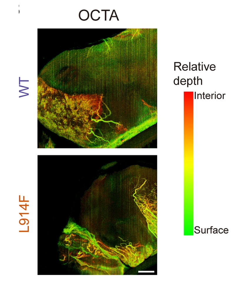 Open access visualization of Microscopy, Perfusion Images, Vascular Transplant, Optical Coherence Tomography Angiography, iVECs