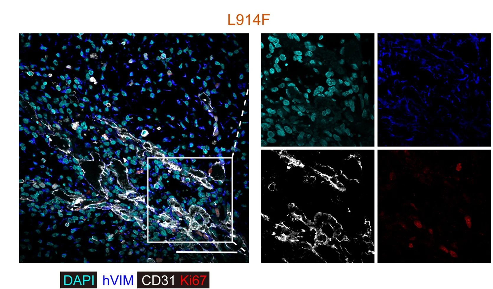 Open access visualization of Microscopy, Immunofluorescent Images, Explants, L914F-iVECs, DAPI
