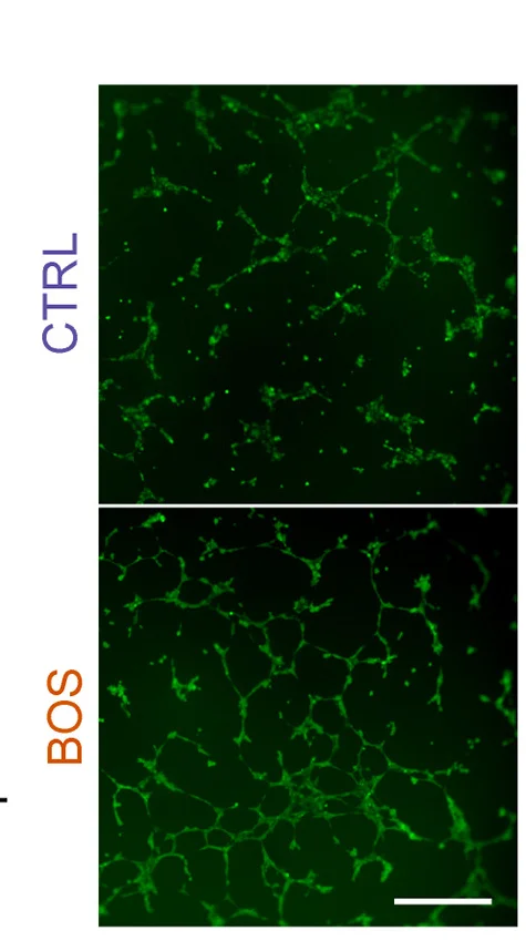 Open access visualization of Microscopy, Perfusion Images, Vascular Transplant, L914F-iVECs, Kidney Capsule
