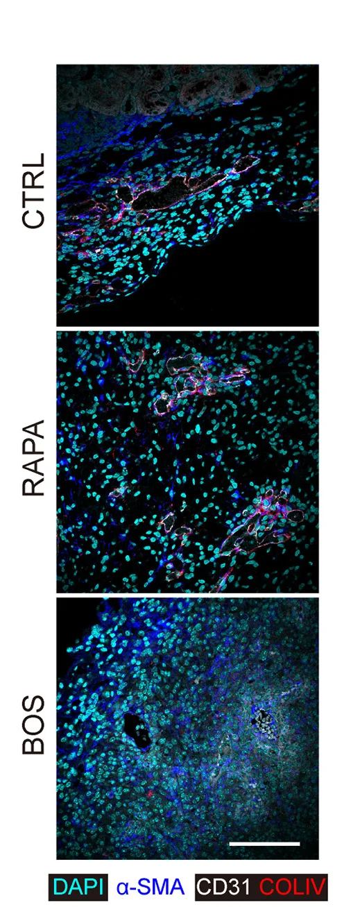 Open access visualization of Microscopy, Immunofluorescent Images, Explants, L914F iVECs, Kidney Capsule