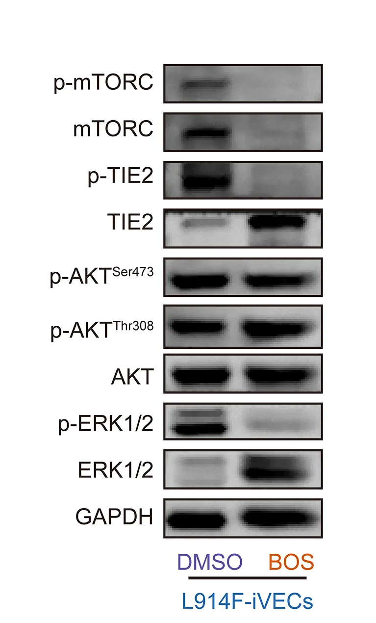 Open access visualization of Gel, Western Blots, Phosphorylation, p-mTORC, p-TIE2