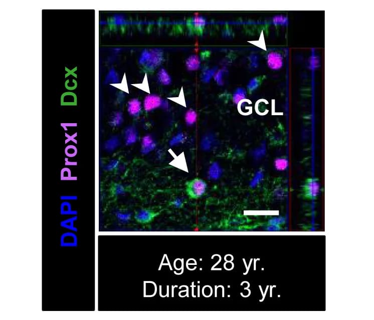 Open access visualization of Microscopy, Dcx, Prox1, Immature Neurons, Mature Granule Neurons
