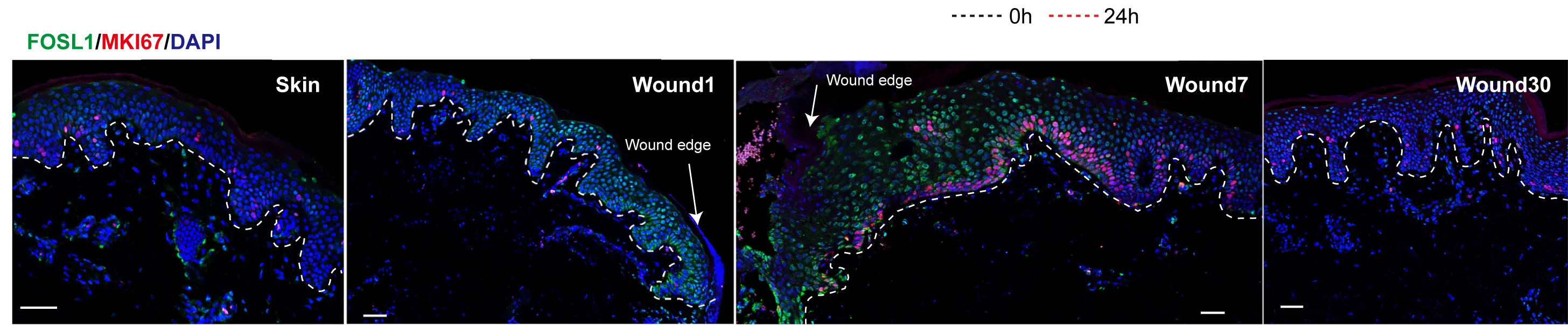Open access visualization of Microscopy, Immunofluorescence Staining, FOSL1, MKI67, Human Acute Wound Healing