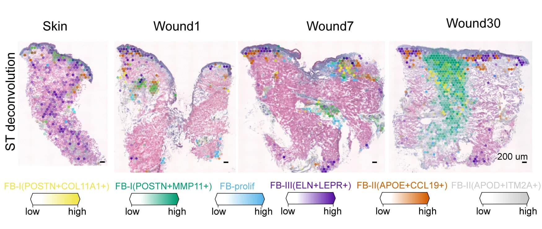 Open access visualization of Microscopy, Scatter Plot, Fibroblast Subpopulations, Deconvolution, ST-seq