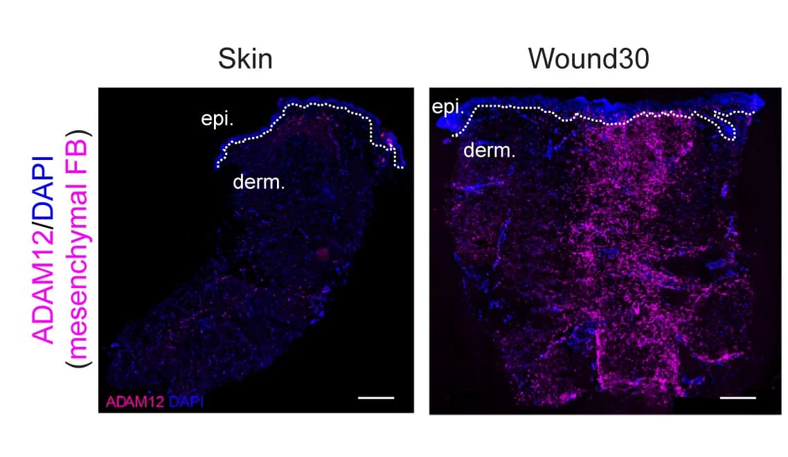 Open access visualization of Microscopy, FISH Images, ADAM12 Expression, Mesenchymal Fibroblast, Skin