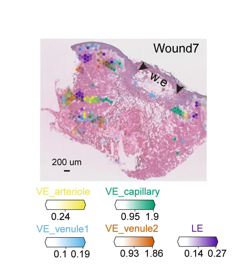 Open access visualization of Microscopy, Endothelial Populations, Deconvolution, ST-seq, Wound7