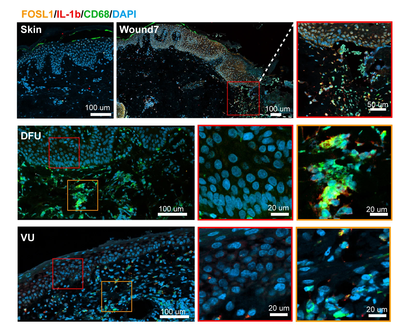 Open access visualization of Microscopy, Immunofluorescence, FOSL1, IL1b, CD68