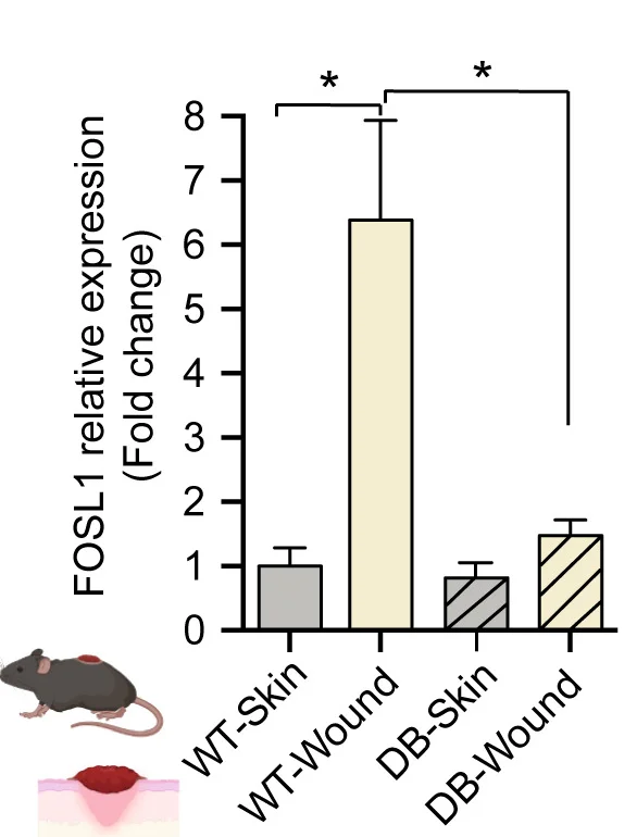 Open access visualization of Bar Plot, Error Bars, Gene Expression, Fosl1, Epidermis