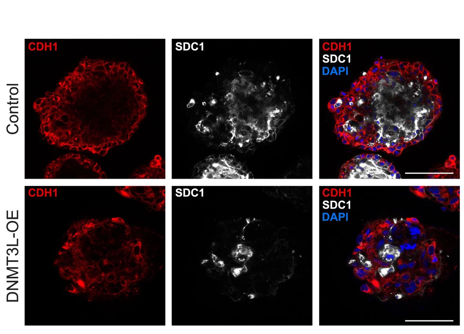 Open access visualization of Microscopy, Immunofluorescence, CDH1, SDC1, DNMT3L-OE hTSC-Orgs