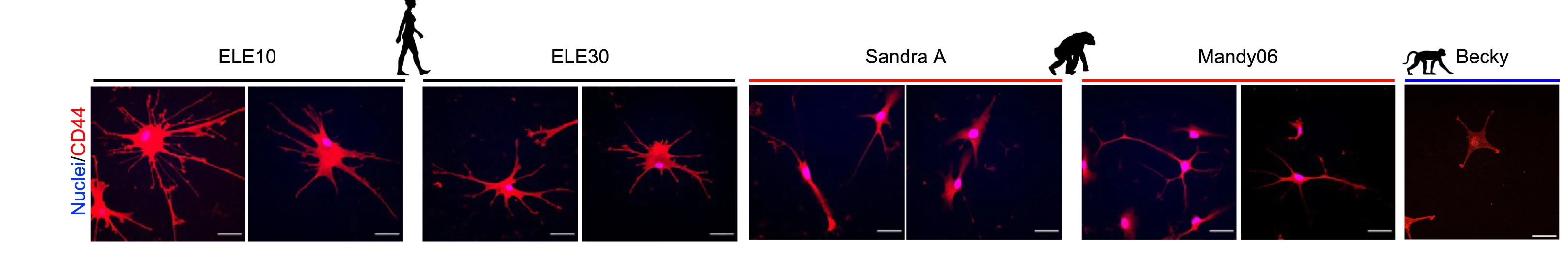 Open access visualization of Microscopy, Human iAstrocytes, Morphology, NHP, CD44-immunostained