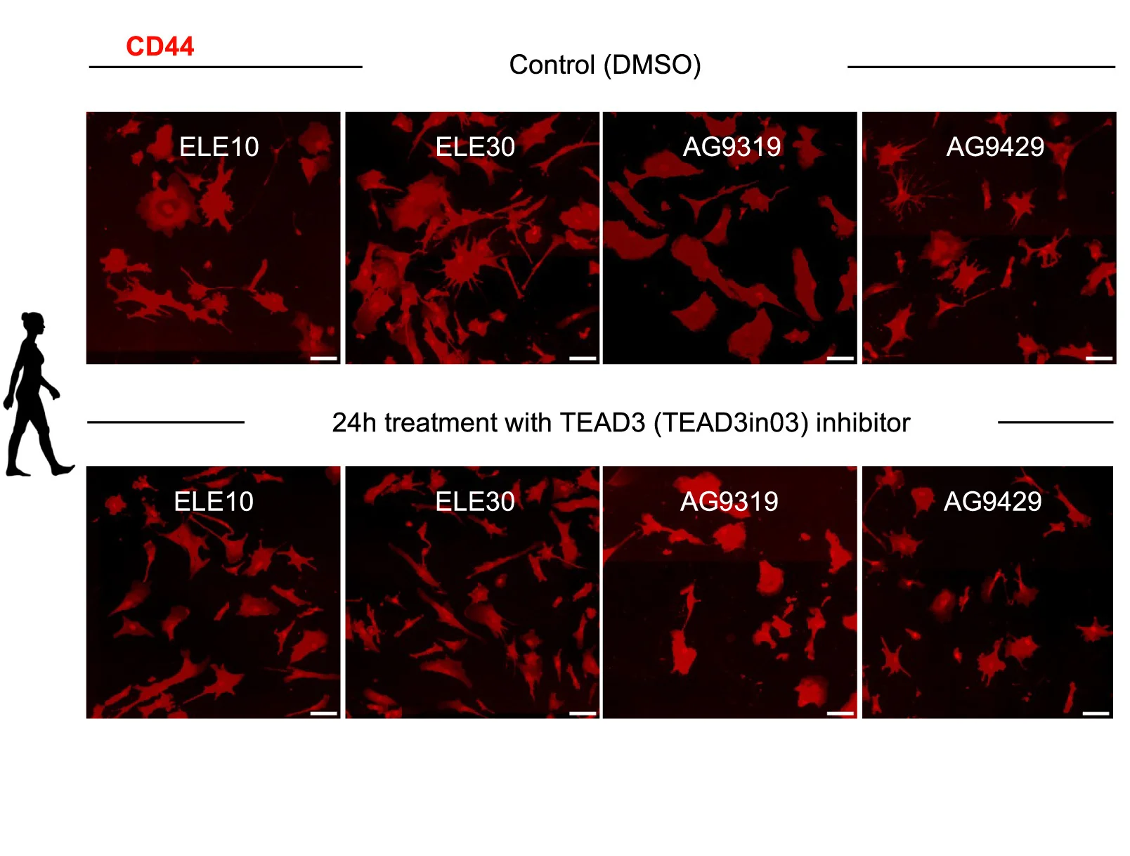 Open access visualization of Microscopy, TEAD3 Inhibition, iAstrocytes, Morphology, CD44