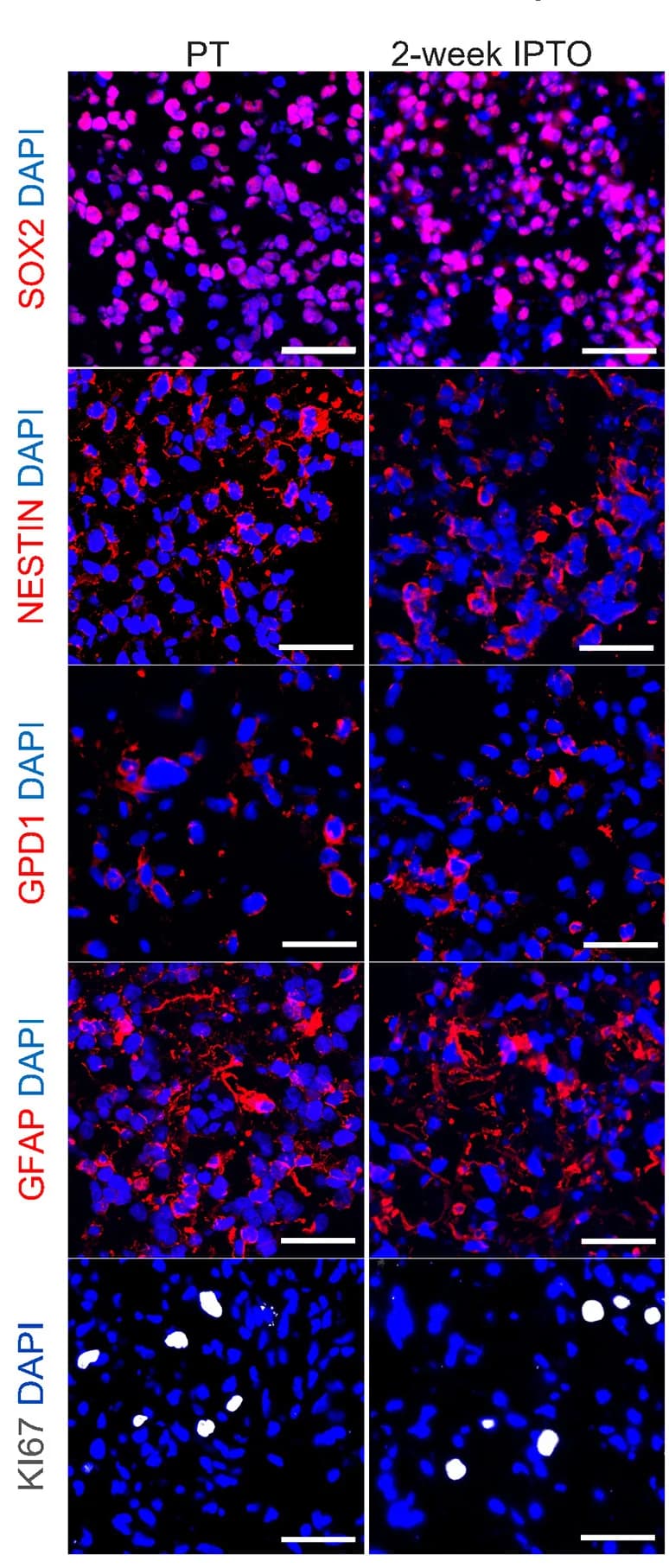 Open access visualization of Microscopy, Immunofluorescent Staining, SOX2, NESTIN, GFAP