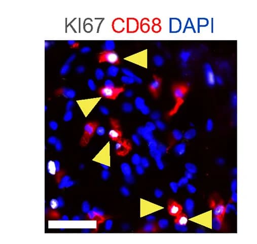 Open access visualization of Microscopy, Immunofluorescent Staining, KI67, TAM, CD68