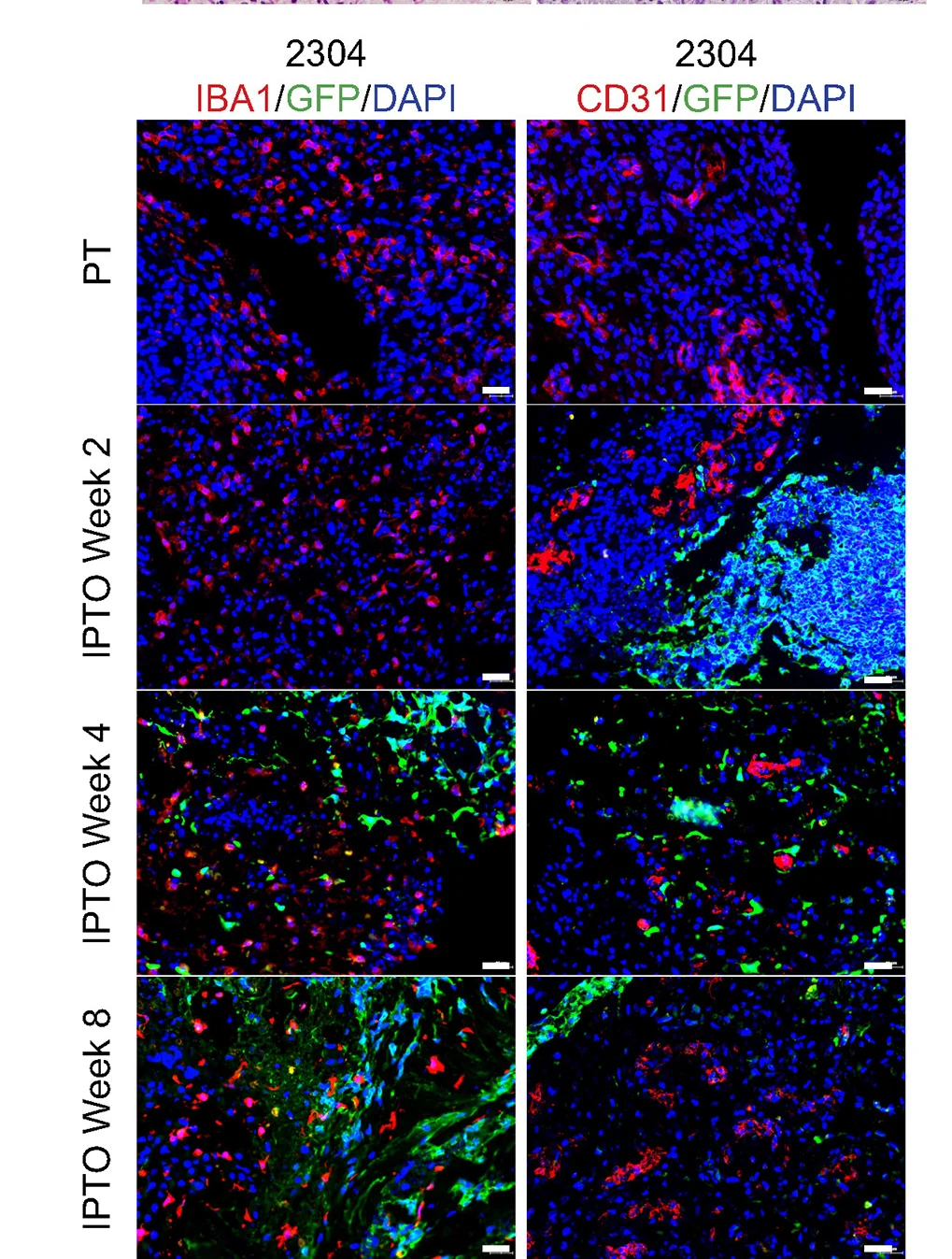 Open access visualization of Microscopy, Immunofluorescent Staining, TAM, IBA1, Vascular Cell