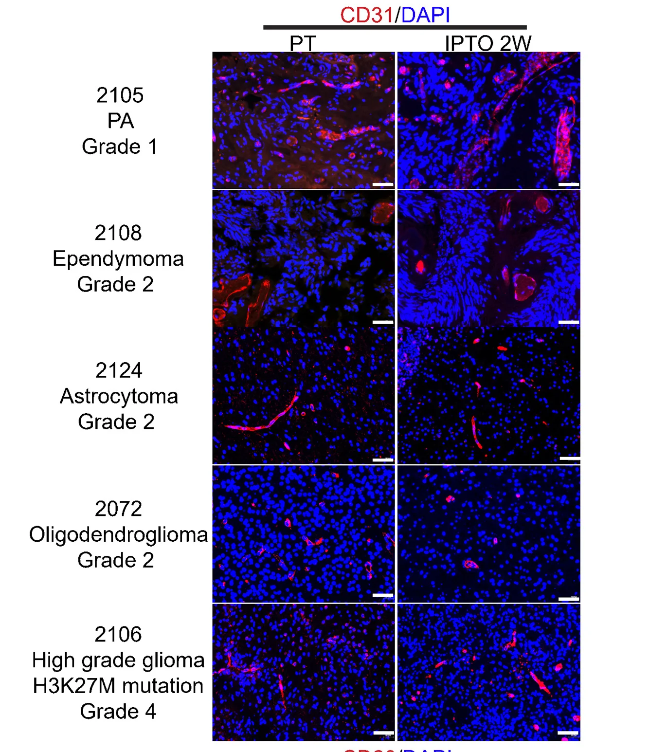 Open access visualization of Microscopy, Immunofluorescent Staining, Vascular Marker CD31, PTs, IPTOs