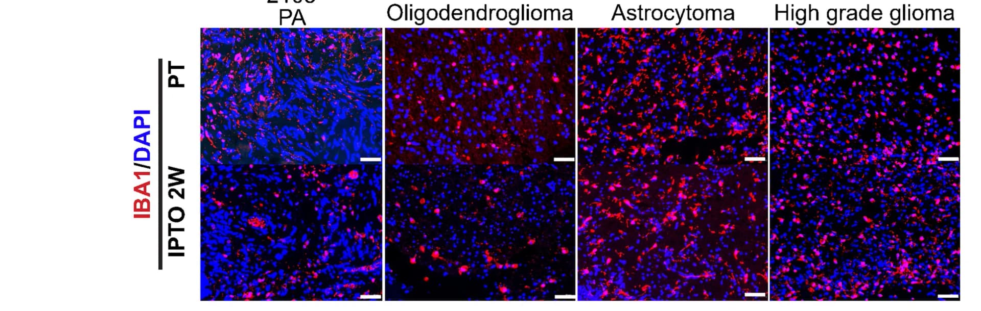 Open access visualization of Microscopy, Immunofluorescent Staining, Macrophage Marker IBA1, PTs, IPTOs