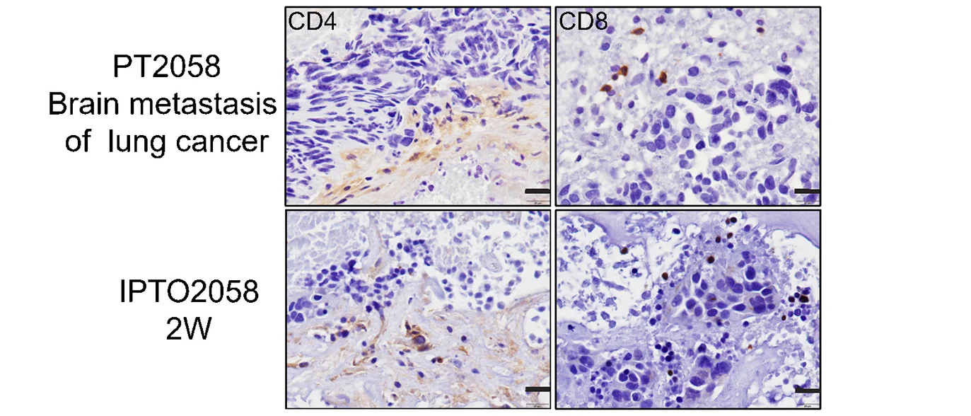 Open access visualization of Microscopy, Immunohistochemistry Staining, T Cell Markers CD4, T Cell Markers CD8, PTs