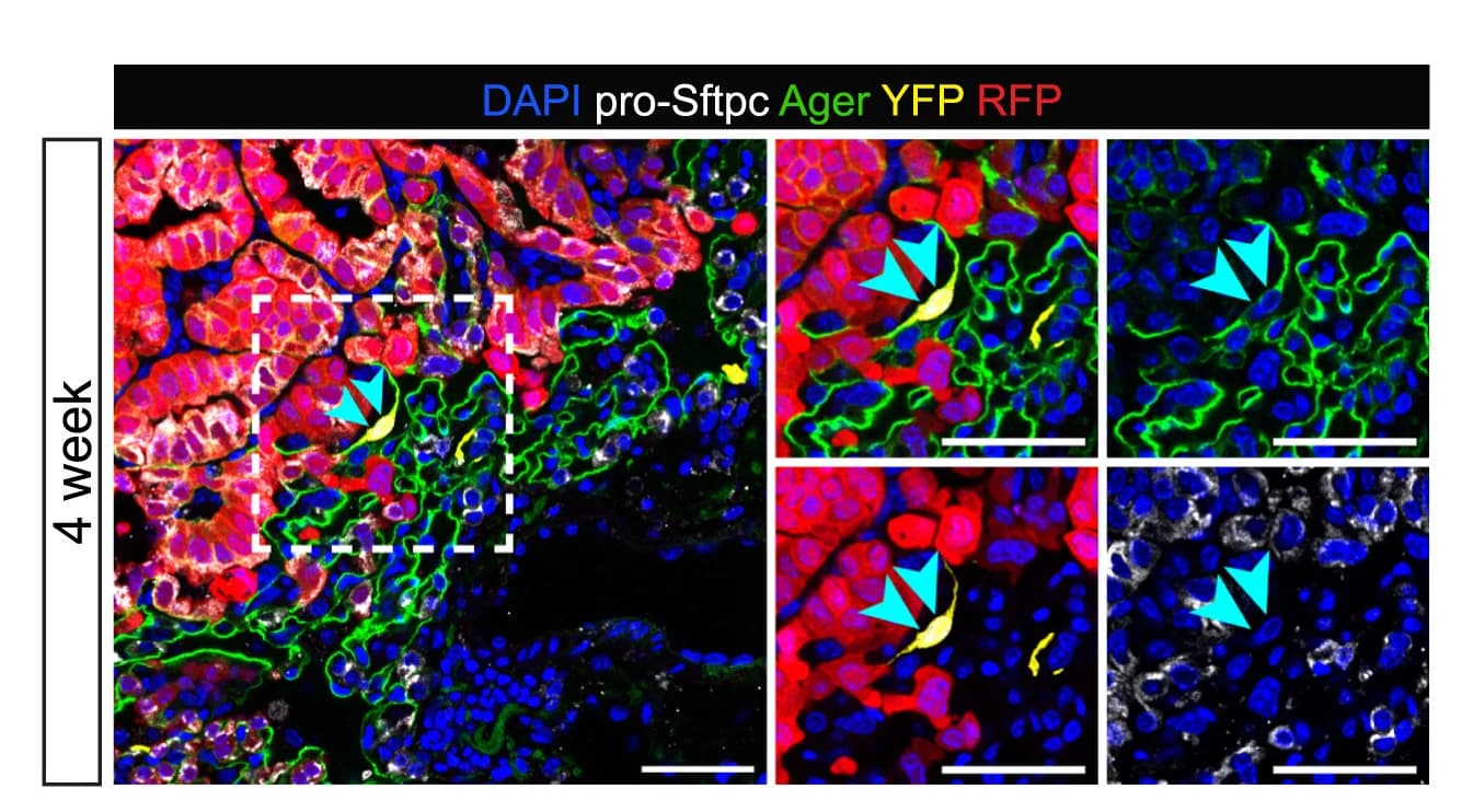 Open access visualization of Microscopy, Confocal Image, YFP+ Cells, Ager, Pro-Sftpc
