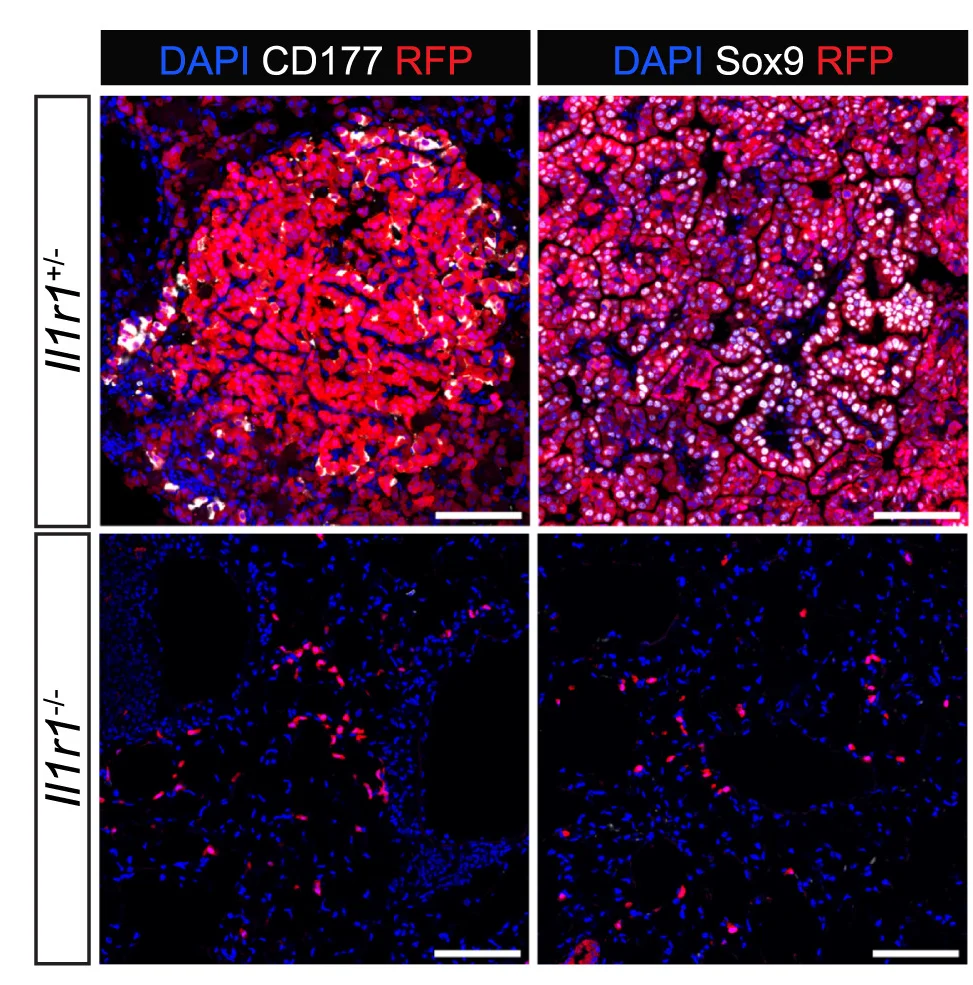 Open access visualization of Microscopy, Confocal Microscopy, CD177, SOX9, Mouse Model
