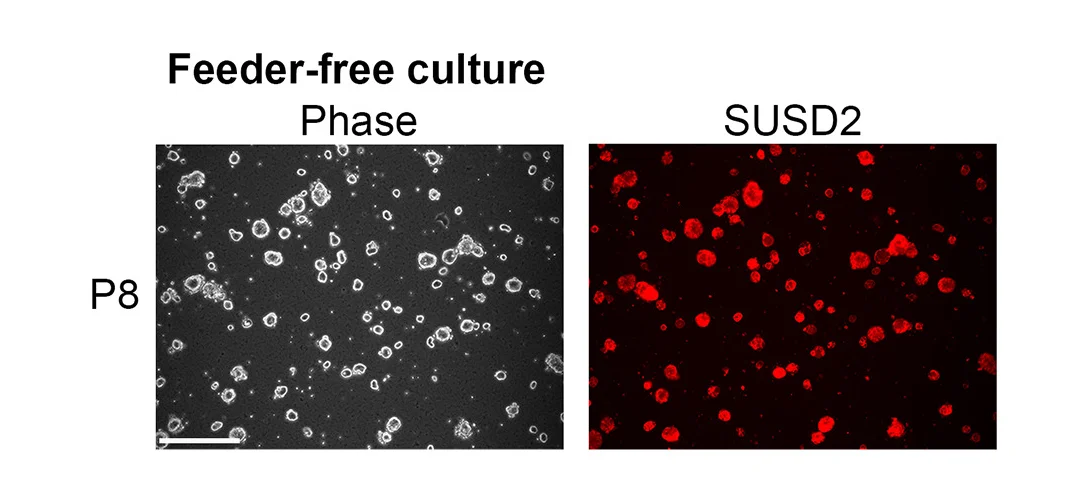 Open access visualization of Microscopy, Photo, SUSD2 Staining, Feeder-Free, Reset PSCs