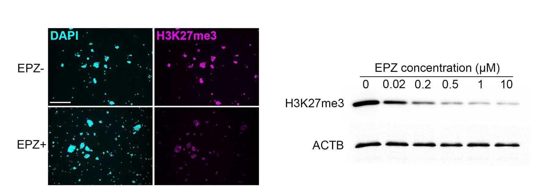 Open access visualization of Microscopy, Gel, Immunostaining, H3K27me3, Immunoblotting
