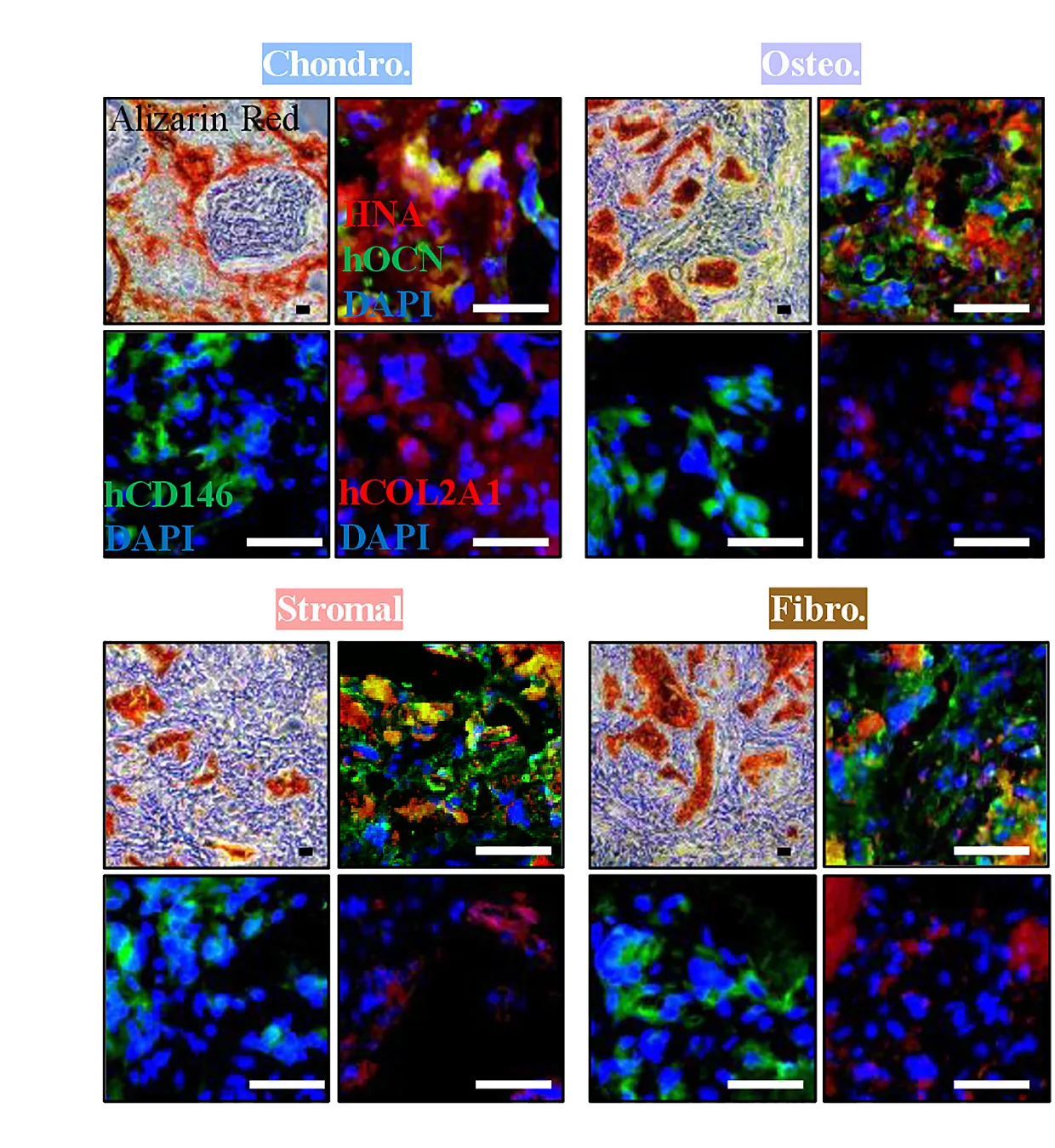 Open access visualization of Microscopy, Alizarin Red S Staining, Immunohistochemistry, Osteogenic, Chondrogenic