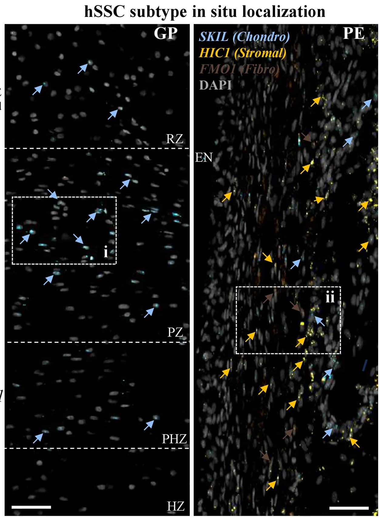Open access visualization of Microscopy, In Situ Validation, hSSC Subtype Marker Expression, Fetal Long Bone, Growth Plate
