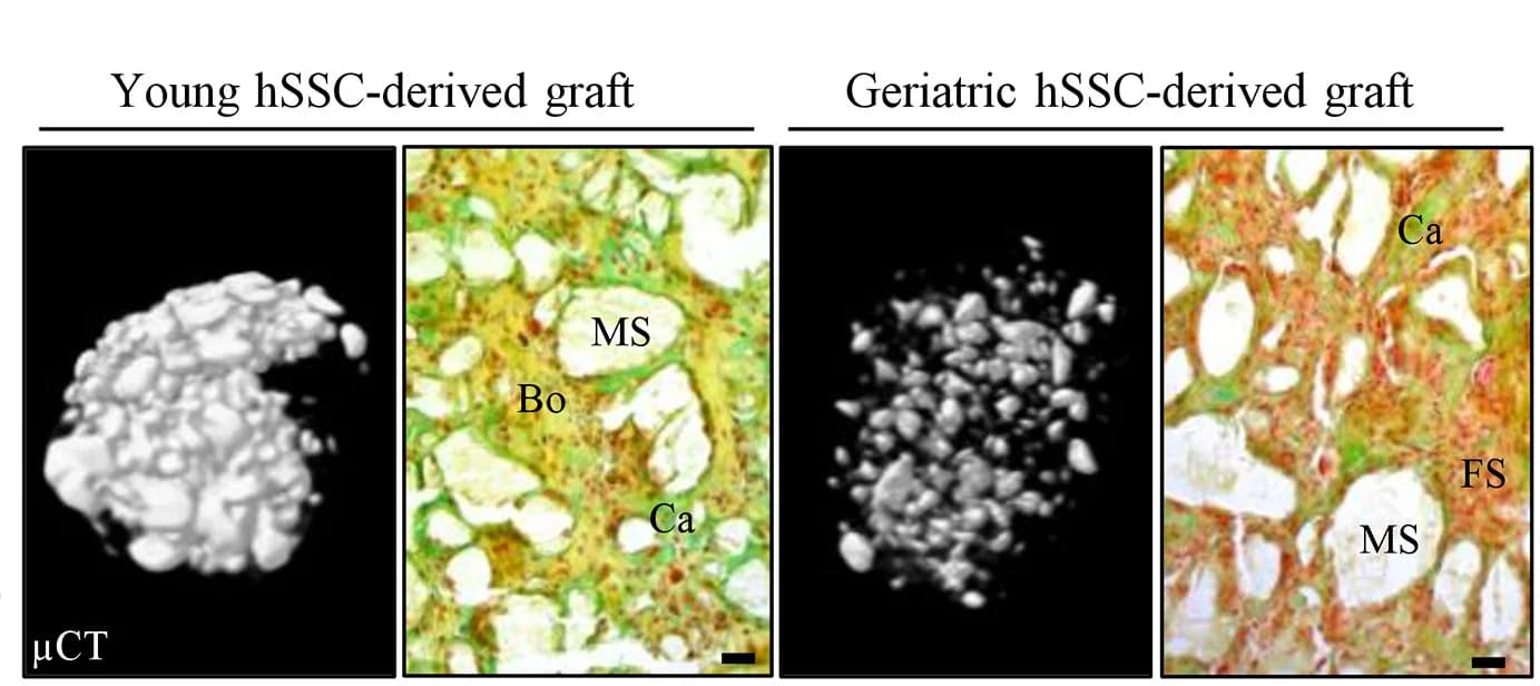 Open access visualization of Microscopy, Subcutaneous Grafts, Young hSSCs, Geriatric hSSCs, Mineralization