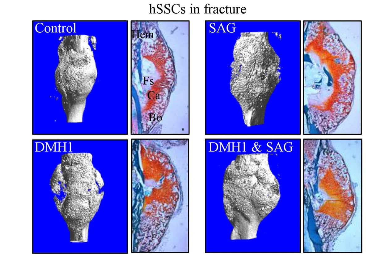 Open access visualization of Microscopy, 3D Plot, Micro-CT, Safranin-O Staining, Fracture Calluses