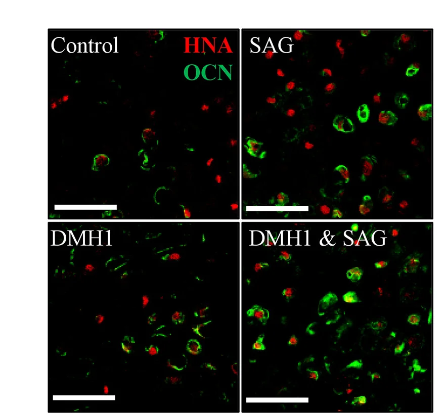 Open access visualization of Microscopy, Immunohistochemistry, hSSC-Derived Cells, Human Nuclear Antigen, Osteocalcin