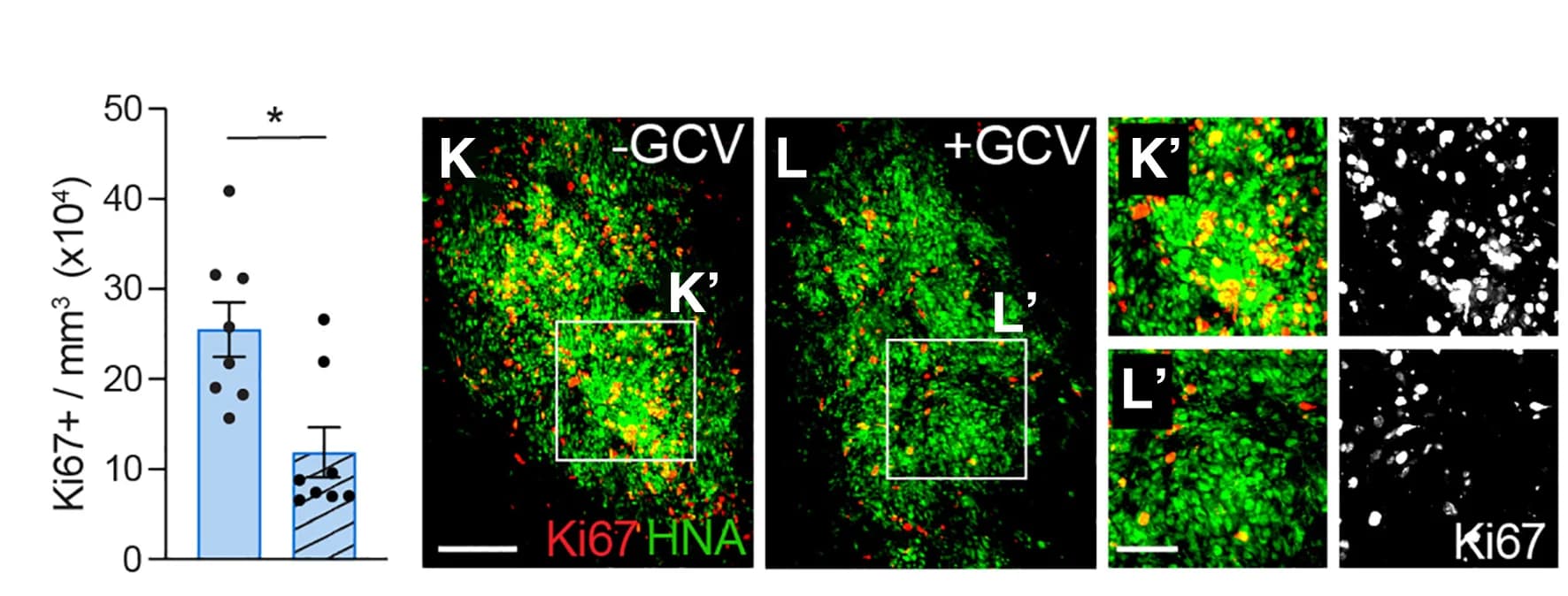 Open access visualization of Bar Plot, Error Bars, Microscopy, KI67+ Proliferating Cells, Ganciclovir