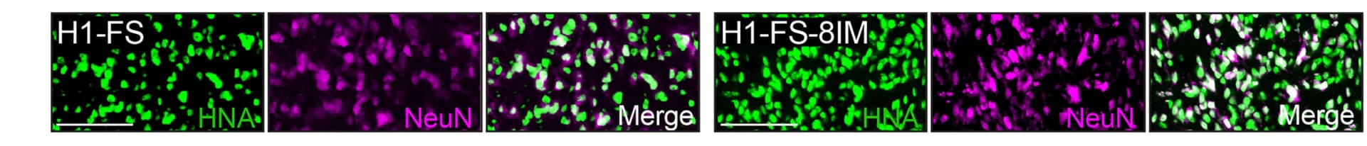 Open access visualization of Microscopy, Representative Images, Cell Density, HNA+ Cells, NeuN+ Neurons