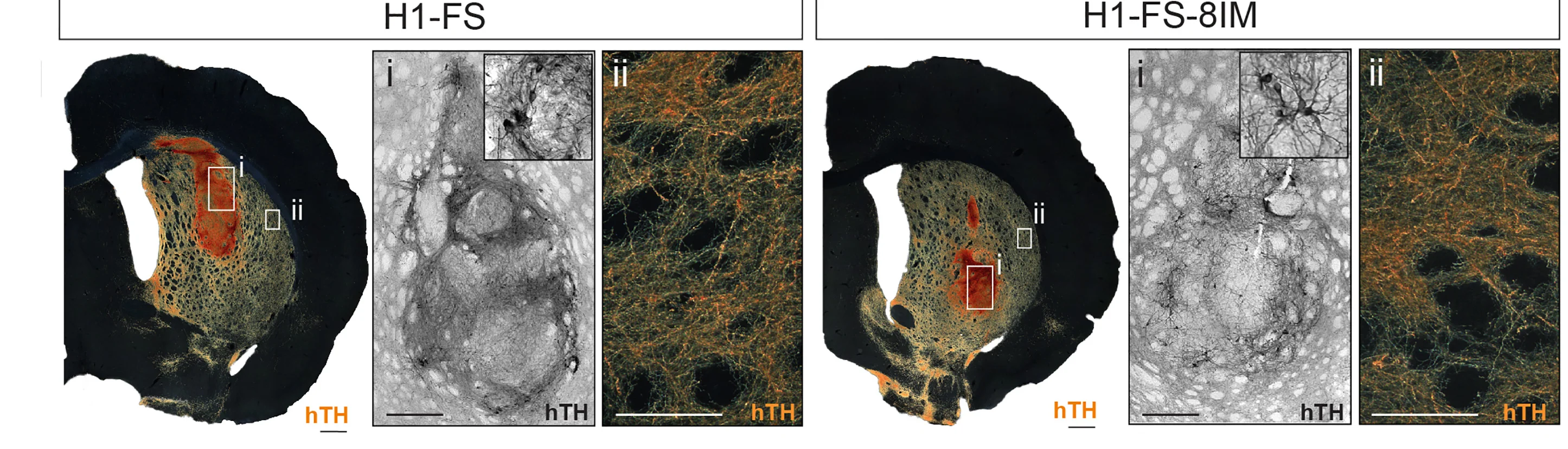Open access visualization of Microscopy, Dark Field Images, hTH Staining, H1-FS, PSC-derived Neural Graft