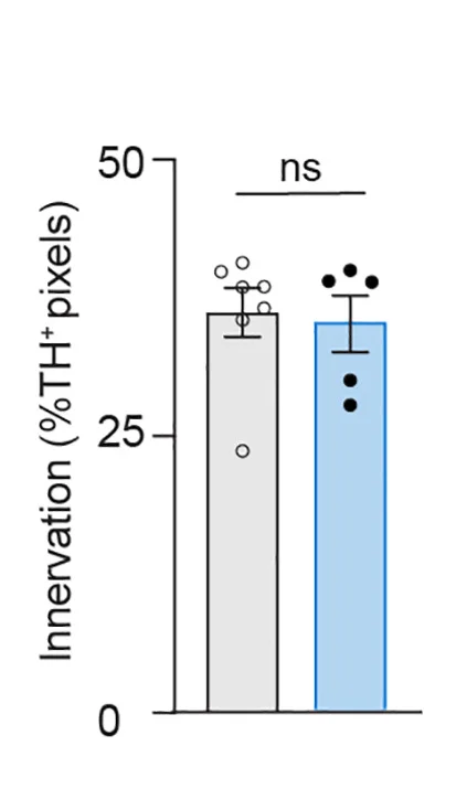 Open access visualization of Bar Plot, Error Bars, Scatter Plot, TH+ Fiber Innervation, Dorsolateral Striatum