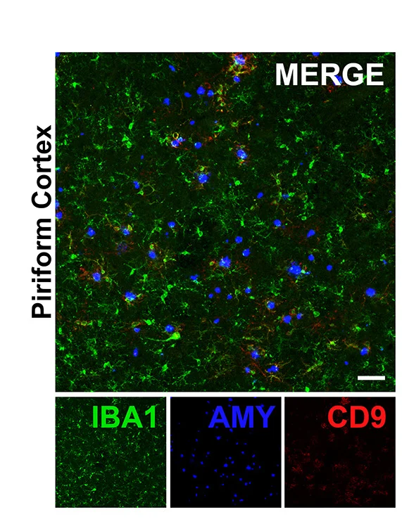 Open access visualization of Microscopy, Confocal Microscopy, CD9, Microglia, Amyloid